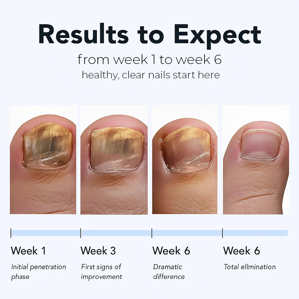 ODALIT™ Nail Repair Patches