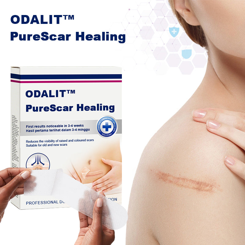 ODALIT™ PureScar Healing Patch (Suitable For Old & New Scars)