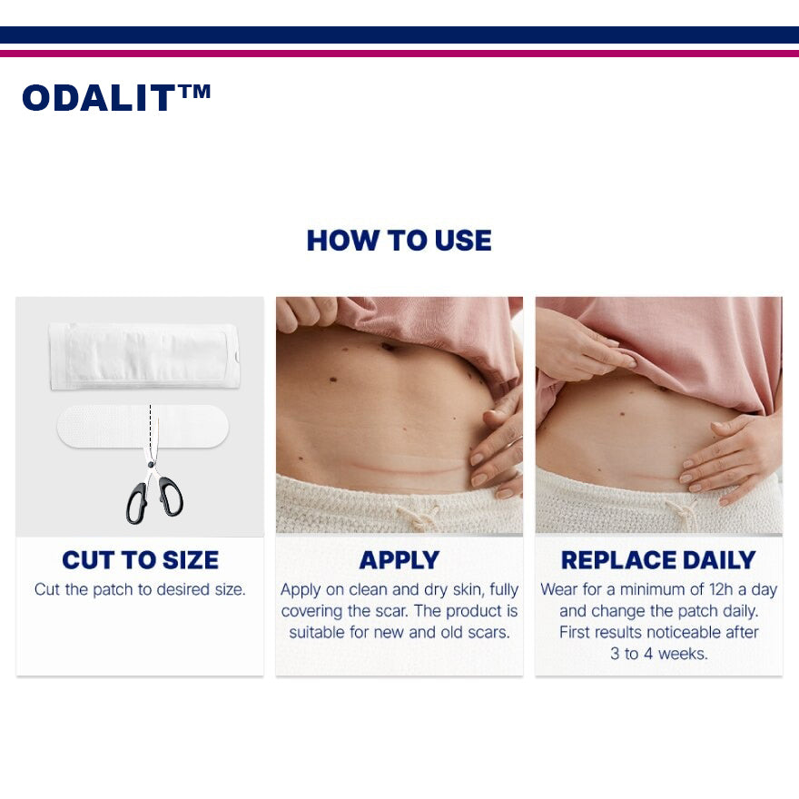 ODALIT™ PureScar Healing Patch (Suitable For Old & New Scars)