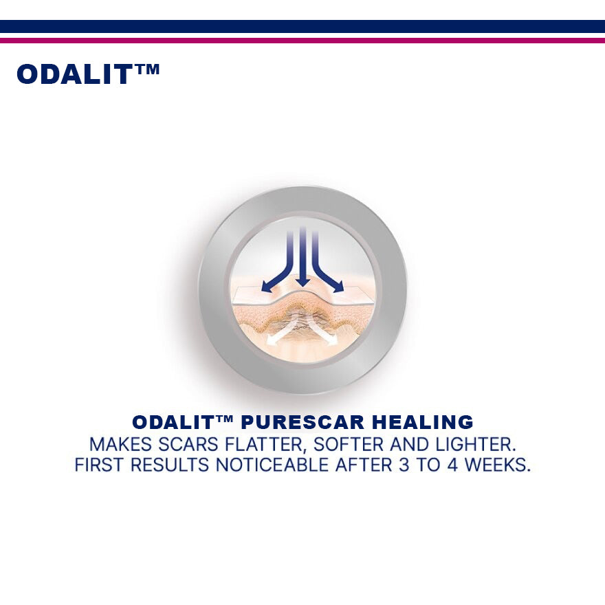 ODALIT™ PureScar Healing Patch (Suitable For Old & New Scars)