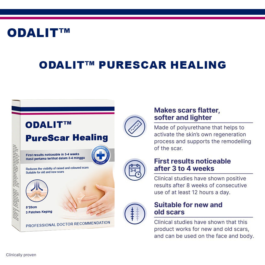 ODALIT™ PureScar Healing Patch (Suitable For Old & New Scars)
