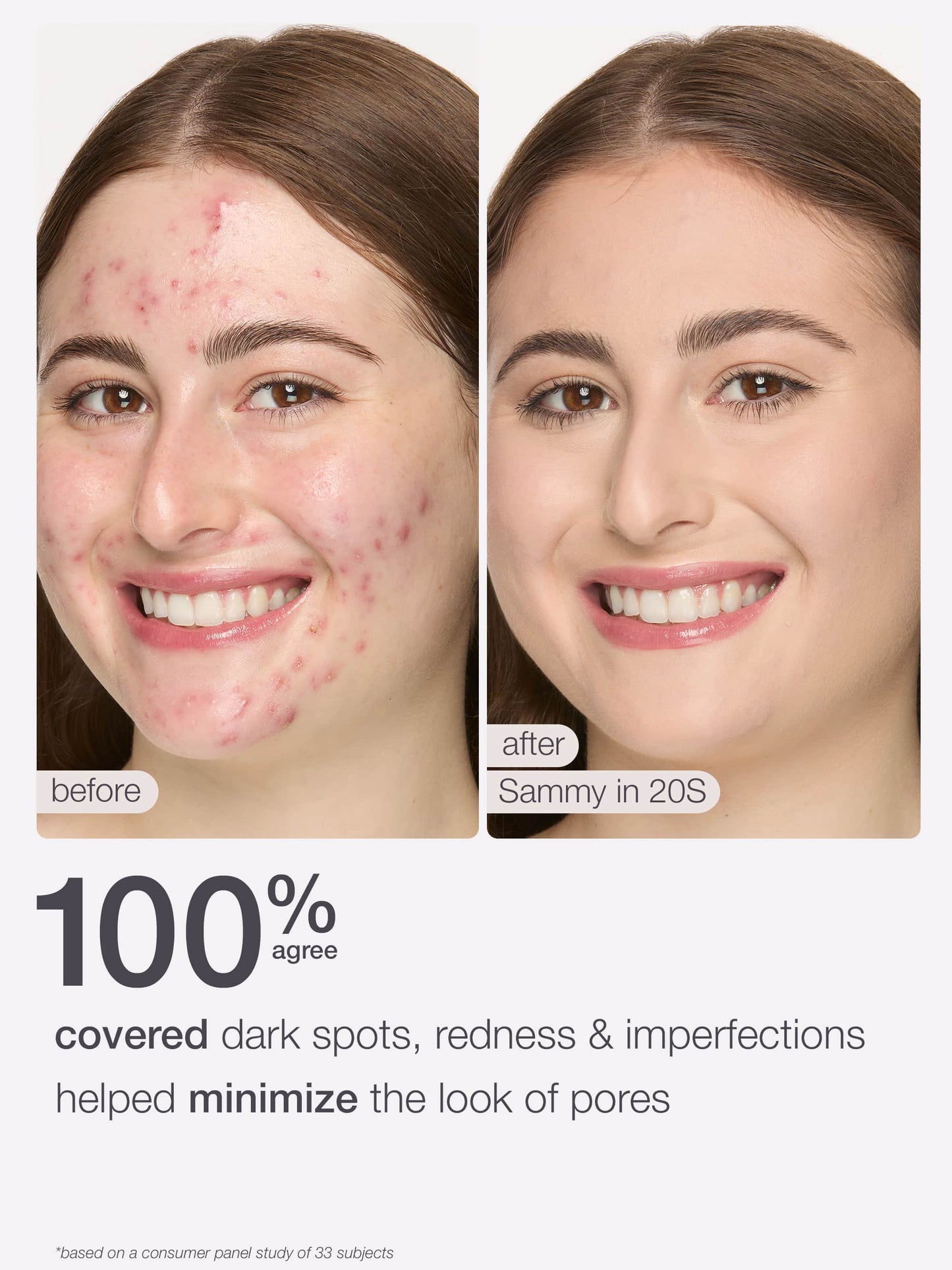 ODALIT™ foundation