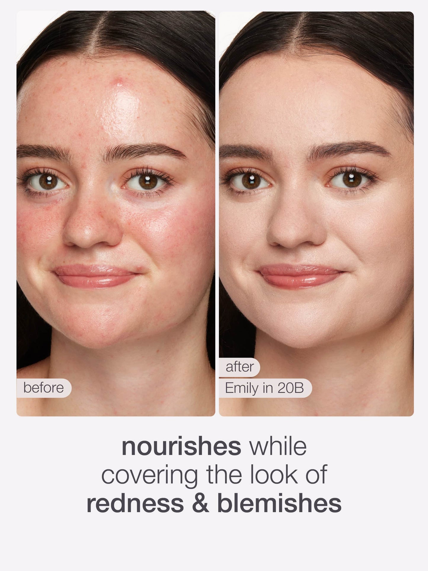 ODALIT™ foundation