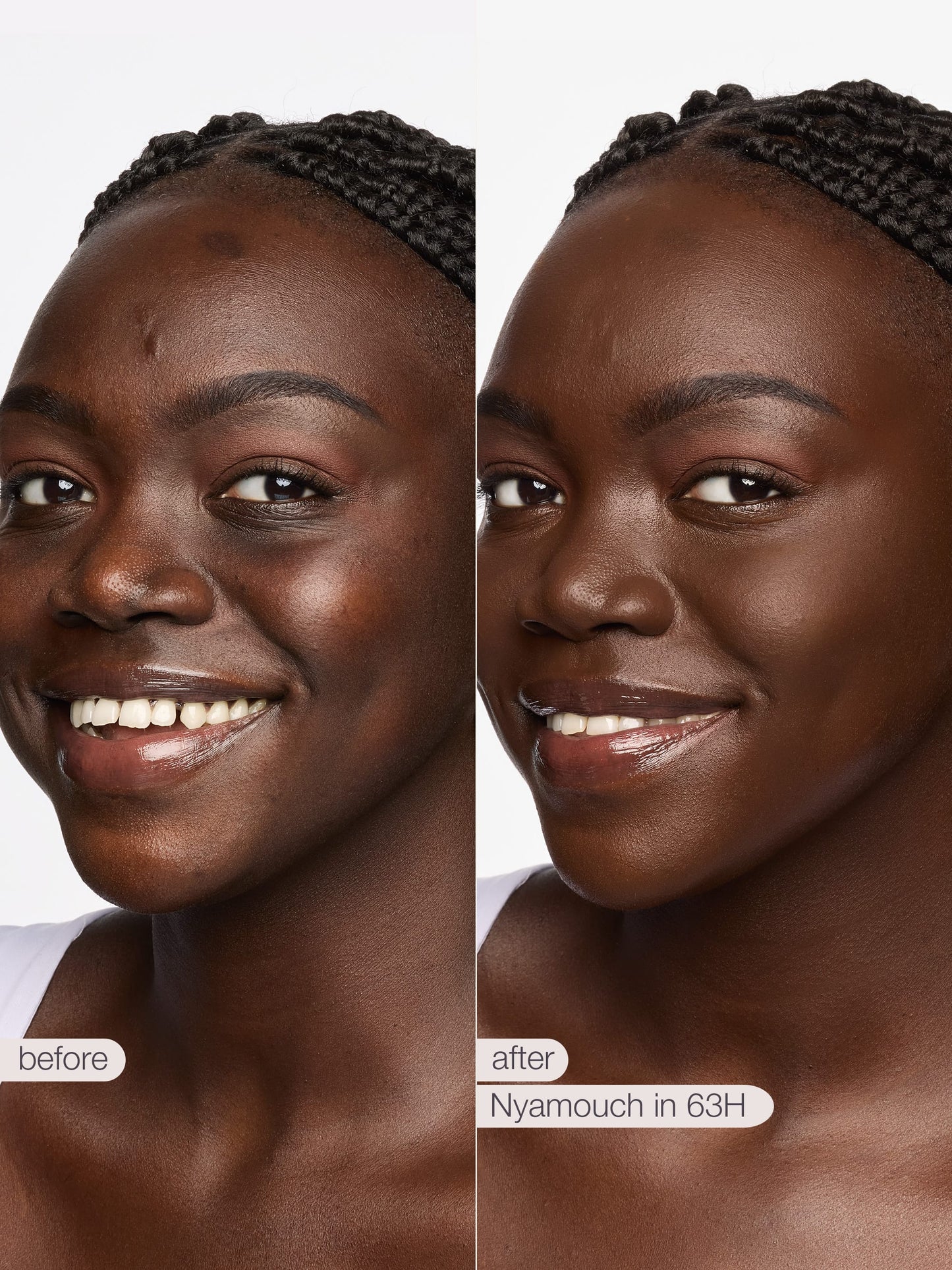 ODALIT™ foundation