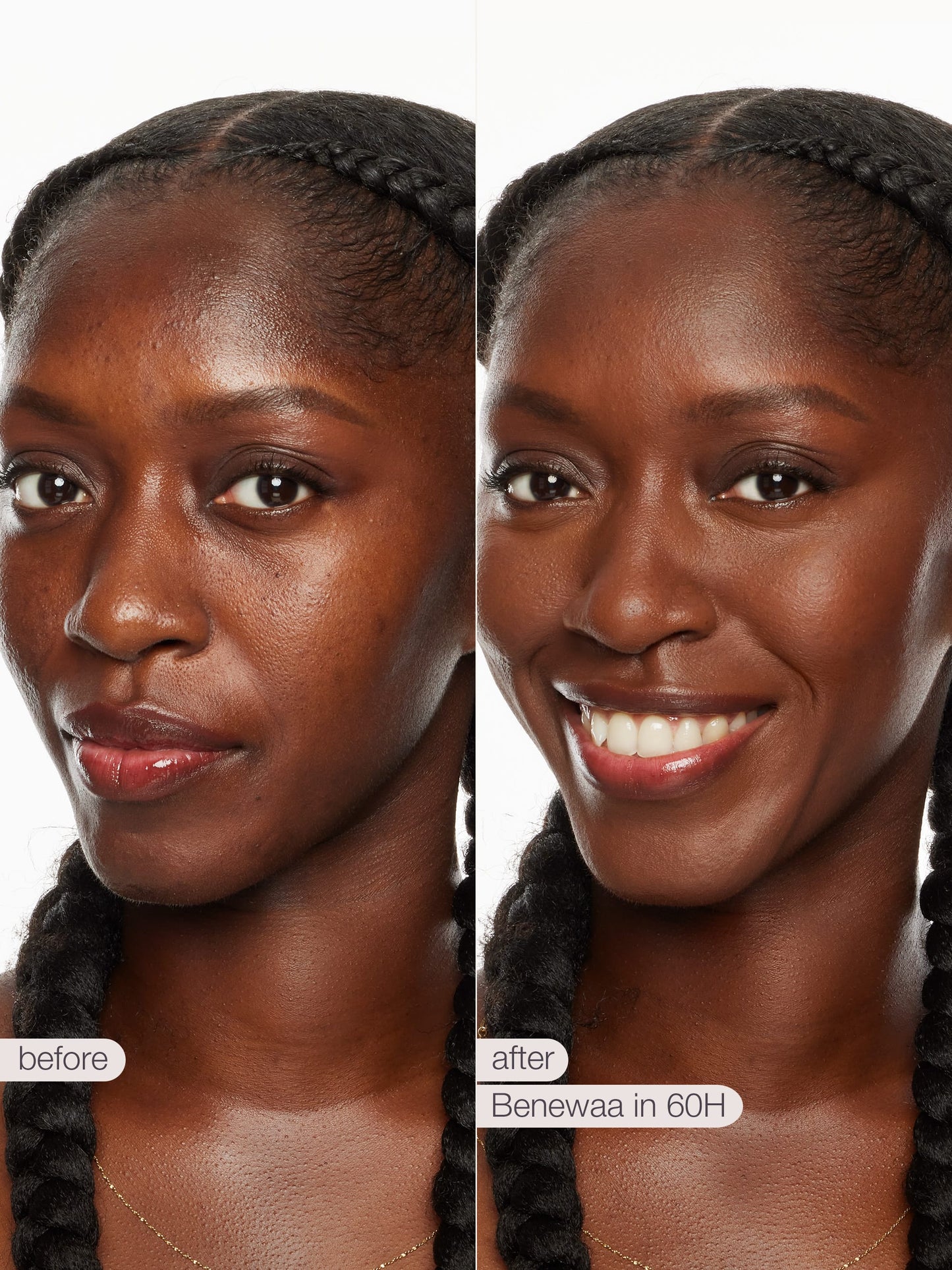ODALIT™ foundation