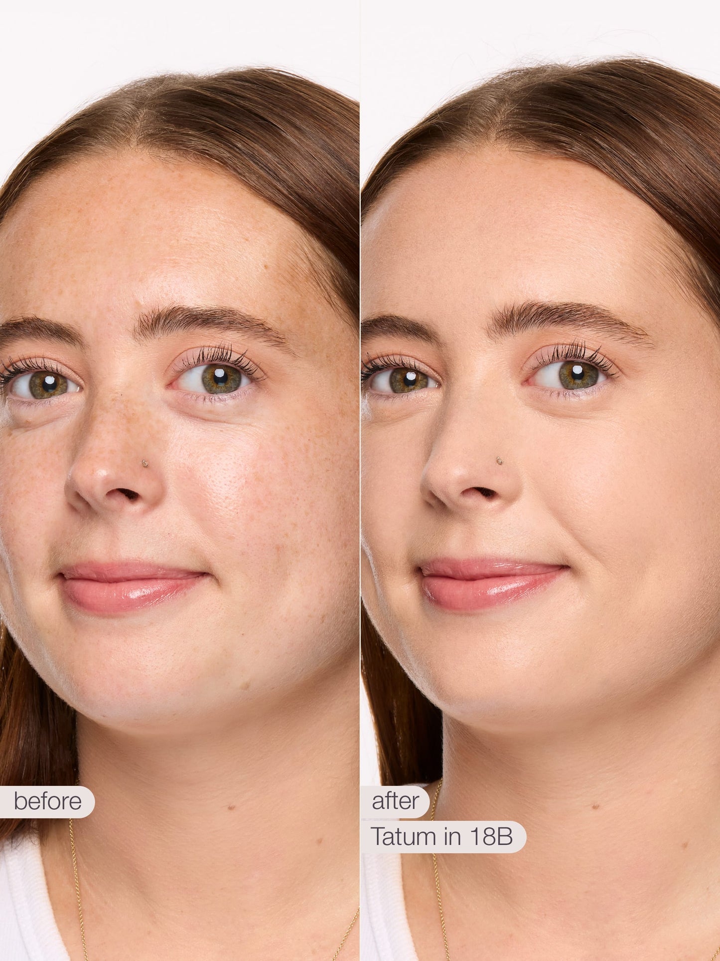 ODALIT™ foundation