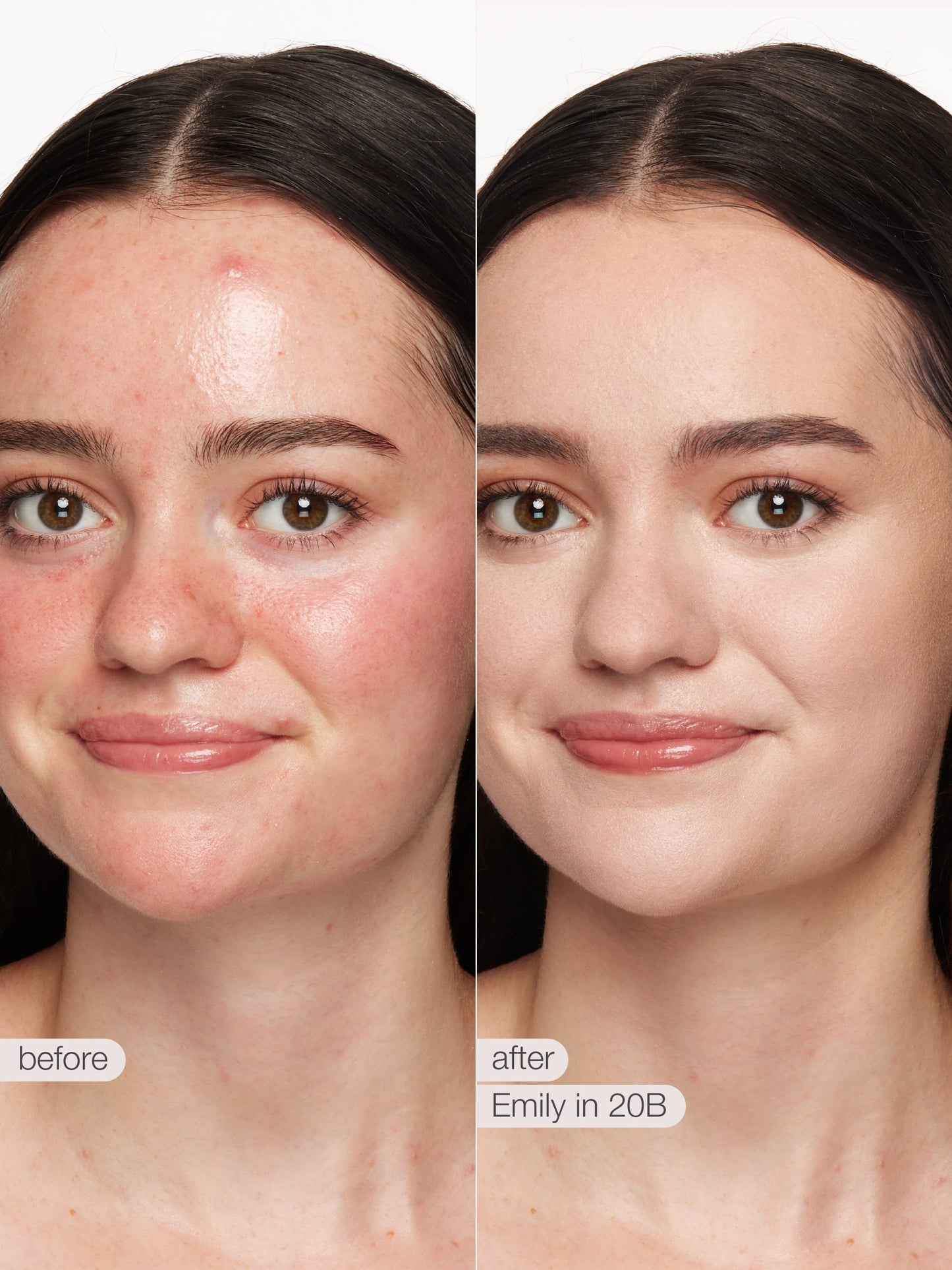 ODALIT™ foundation