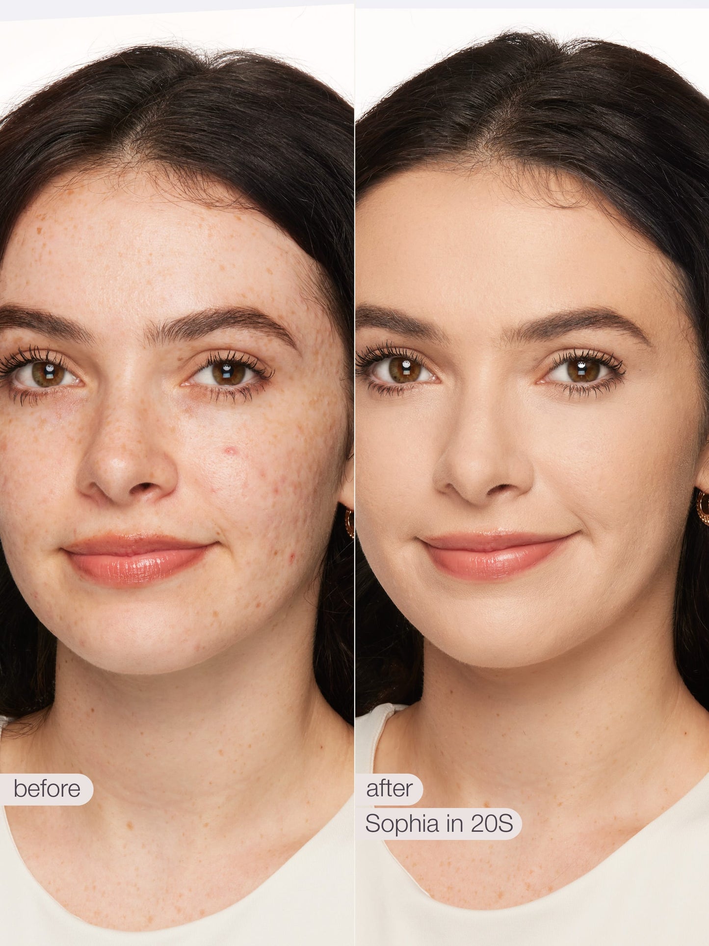 ODALIT™ foundation
