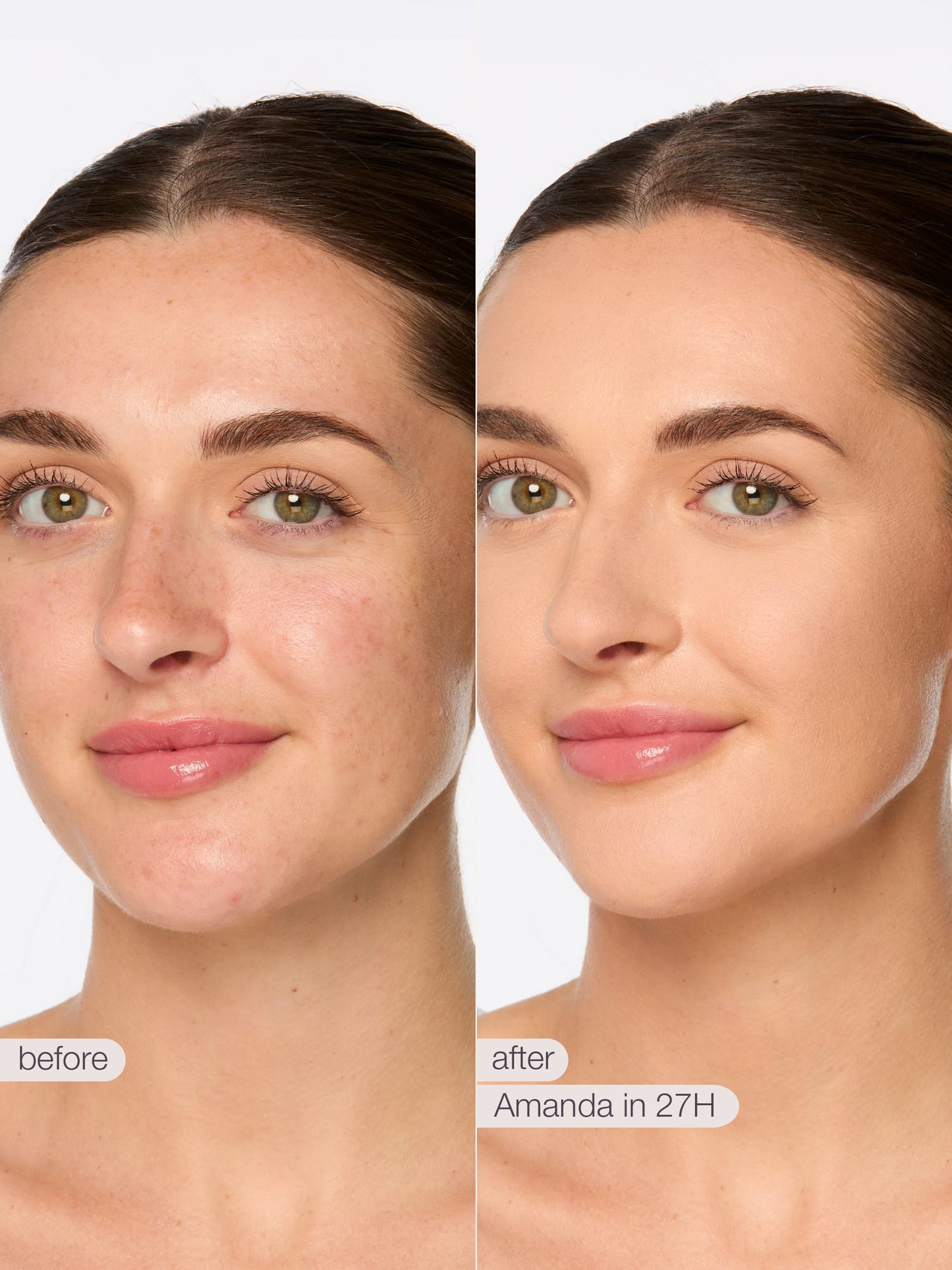 ODALIT™ foundation