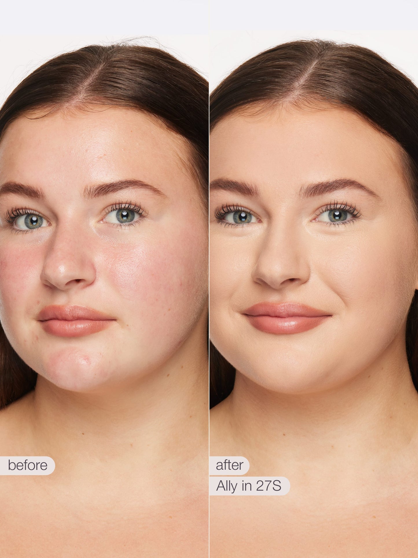 ODALIT™ foundation