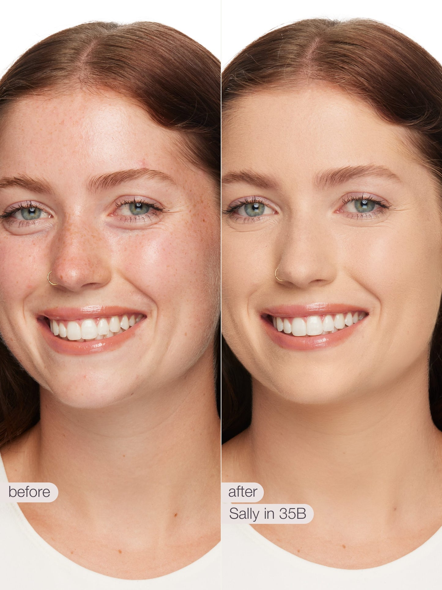 ODALIT™ foundation