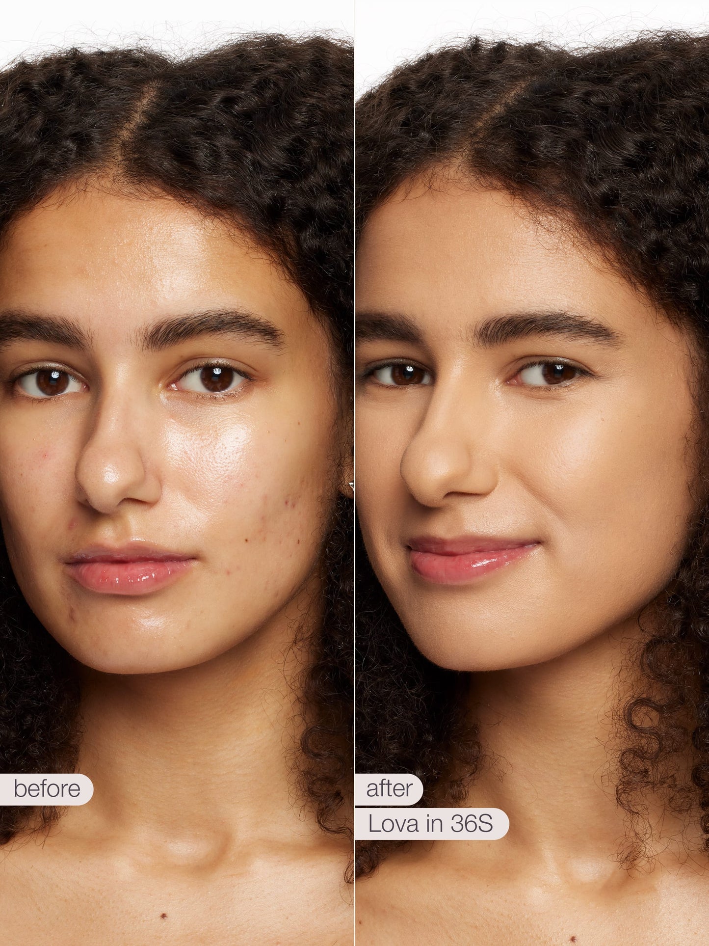 ODALIT™ foundation