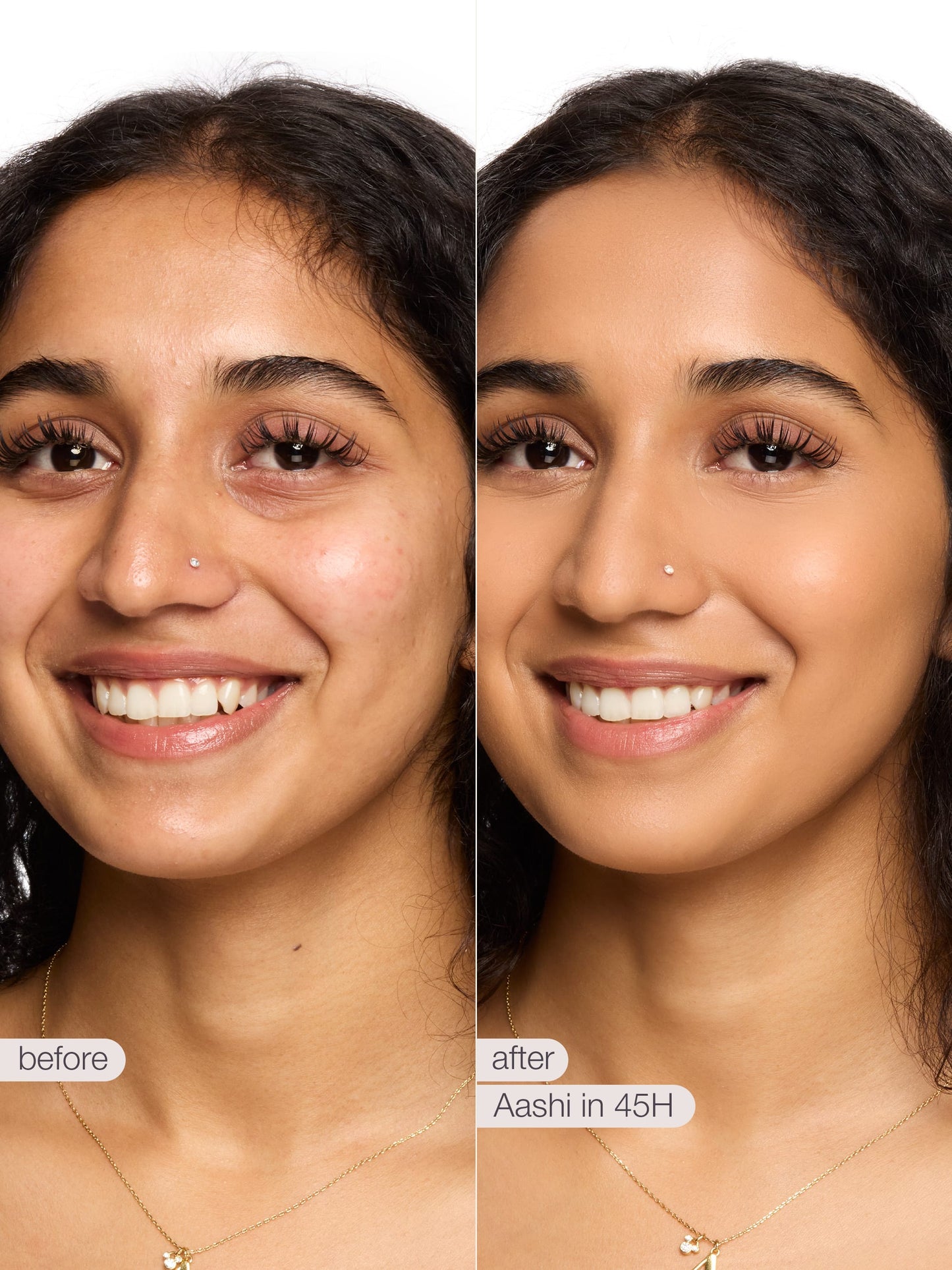 ODALIT™ foundation
