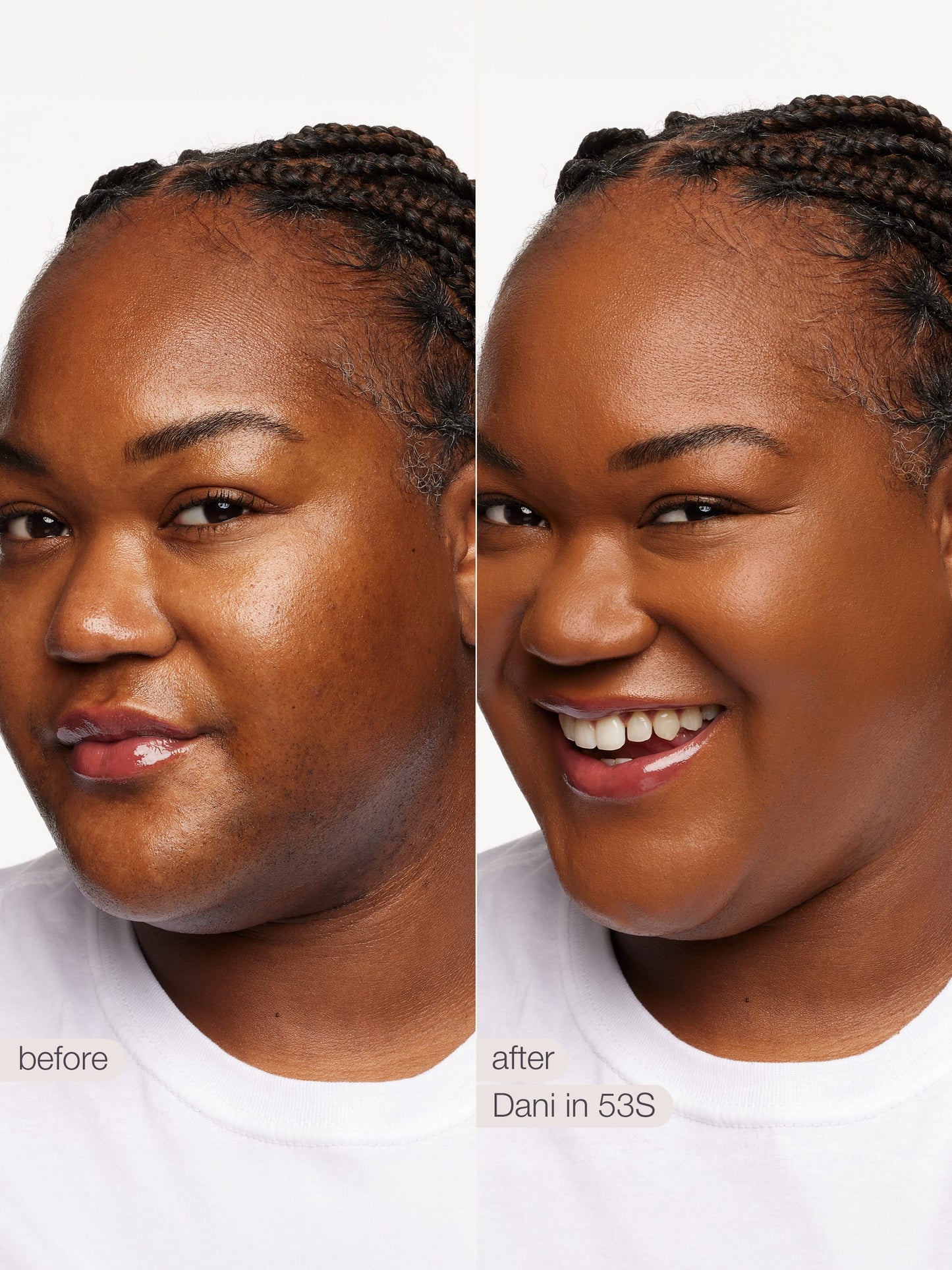 ODALIT™ foundation