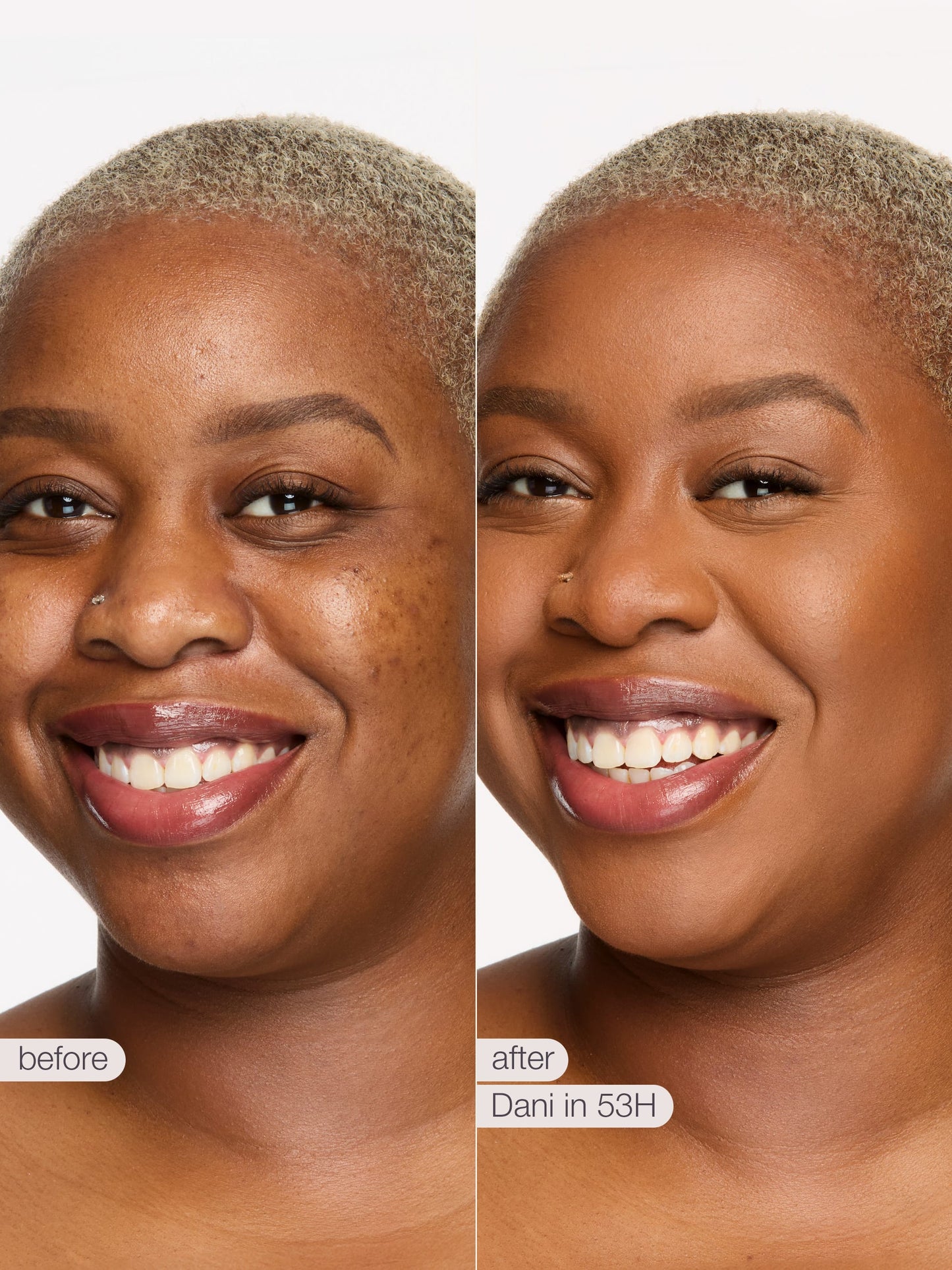 ODALIT™ foundation