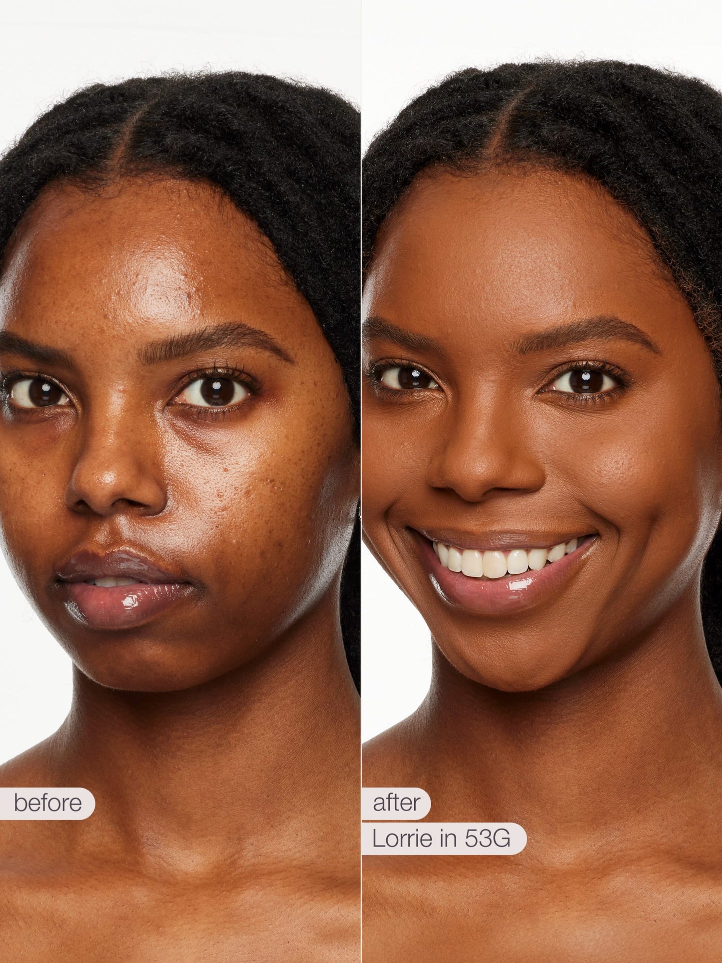 ODALIT™ foundation