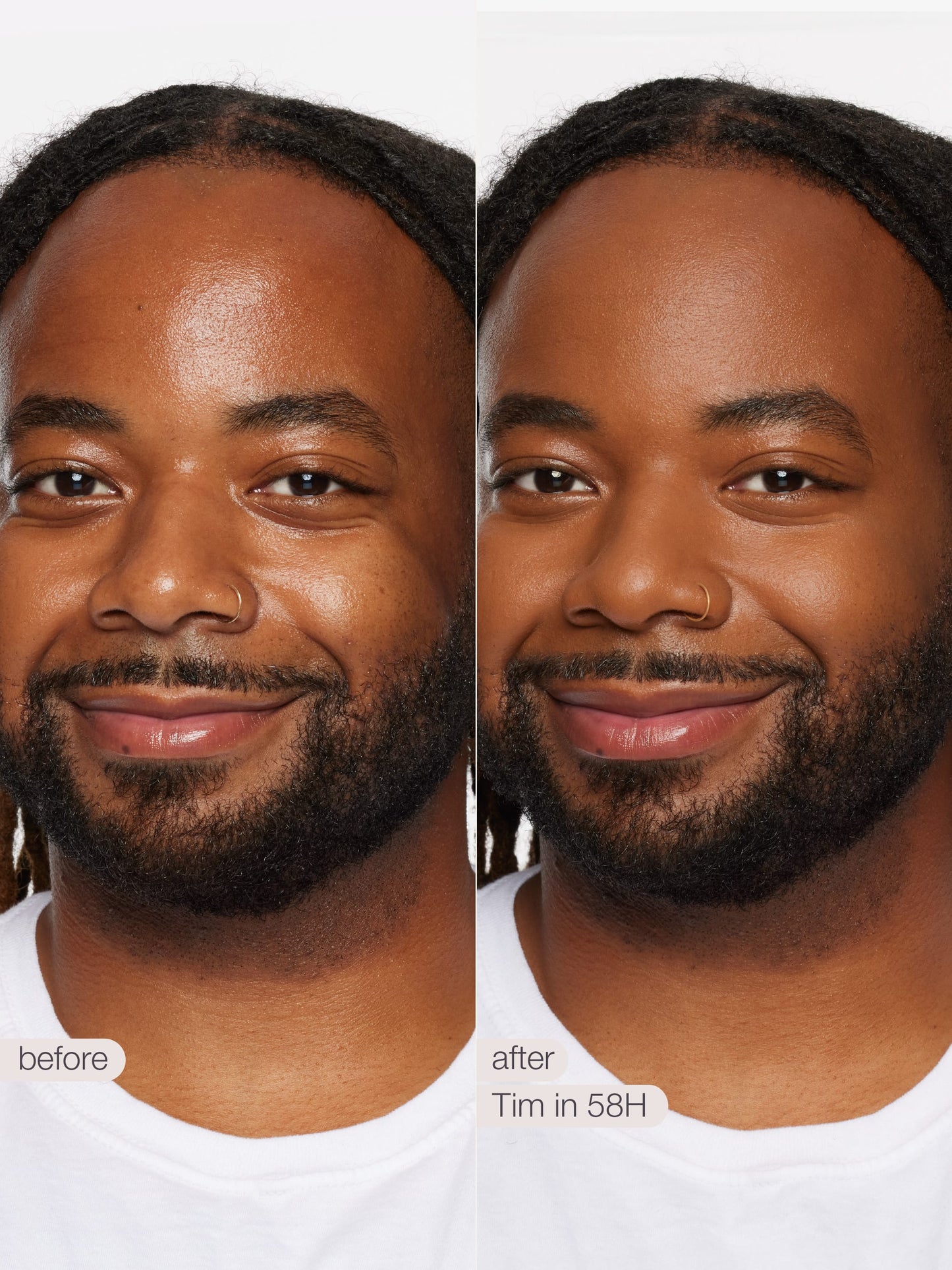 ODALIT™ foundation