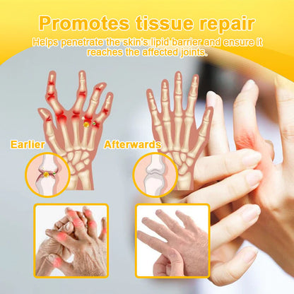 ODALIT™ Botulinum Toxin & Bee Essence Pain-Relief Bone Healing Cream