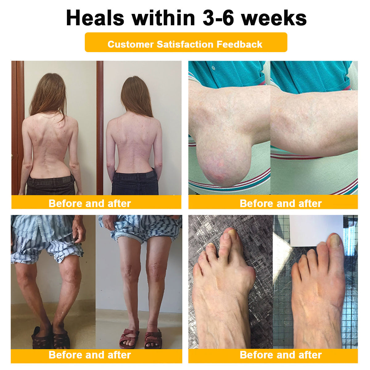 ODALIT™ Botulinum Toxin & Bee Essence Pain-Relief Bone Healing Cream
