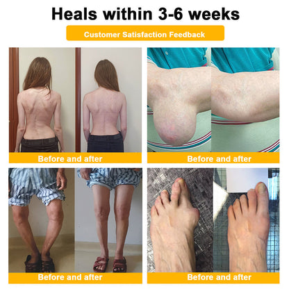 ODALIT™ Botulinum Toxin & Bee Essence Pain-Relief Bone Healing Cream