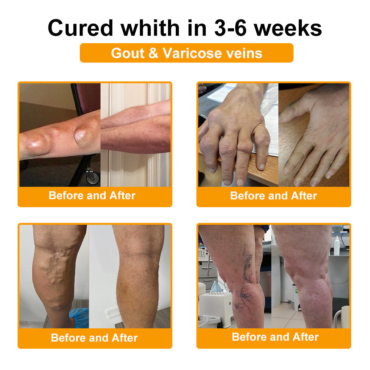ODALIT™ Botulinum Toxin & Bee Essence Pain-Relief Bone Healing Cream