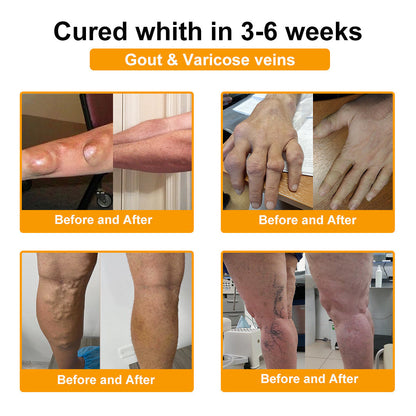 ODALIT™ Botulinum Toxin & Bee Essence Pain-Relief Bone Healing Cream
