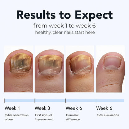 ODALIT™ Nail Repair Patches
