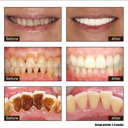 ODALIT™ Niacinamide Whitening Toothpaste-max