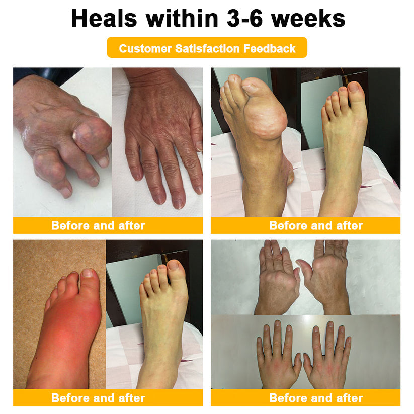 ODALIT™ Botulinum Toxin & Bee Essence Pain-Relief Bone Healing Cream