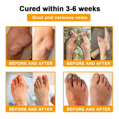 ODALIT™ Botulinum Toxin & Bee Essence Pain-Relief Bone Healing Cream