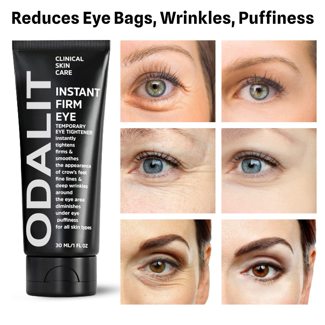 Final 3 Hours: 70%OFF🔥 ODALIT Instant Firm Eye Tightening Cream- Eliminates eye bags & wrinkles 👁✨