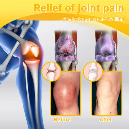 ODALIT™ Botulinum Toxin & Bee Essence Pain-Relief Bone Healing Cream