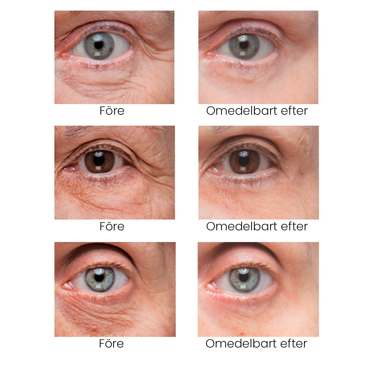 Final 3 Hours: 70%OFF🔥 ODALIT Instant Firm Eye Tightening Cream- Eliminates eye bags & wrinkles 👁✨