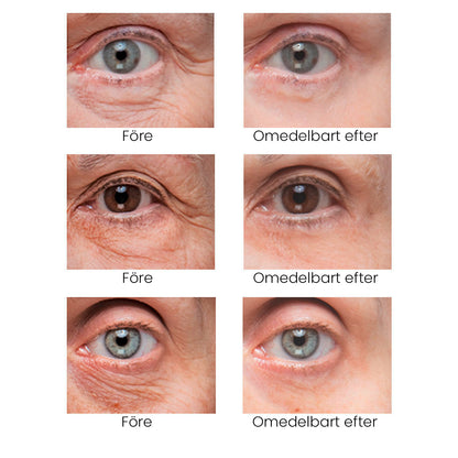 Final 3 Hours: 70%OFF🔥 ODALIT Instant Firm Eye Tightening Cream- Eliminates eye bags & wrinkles 👁✨