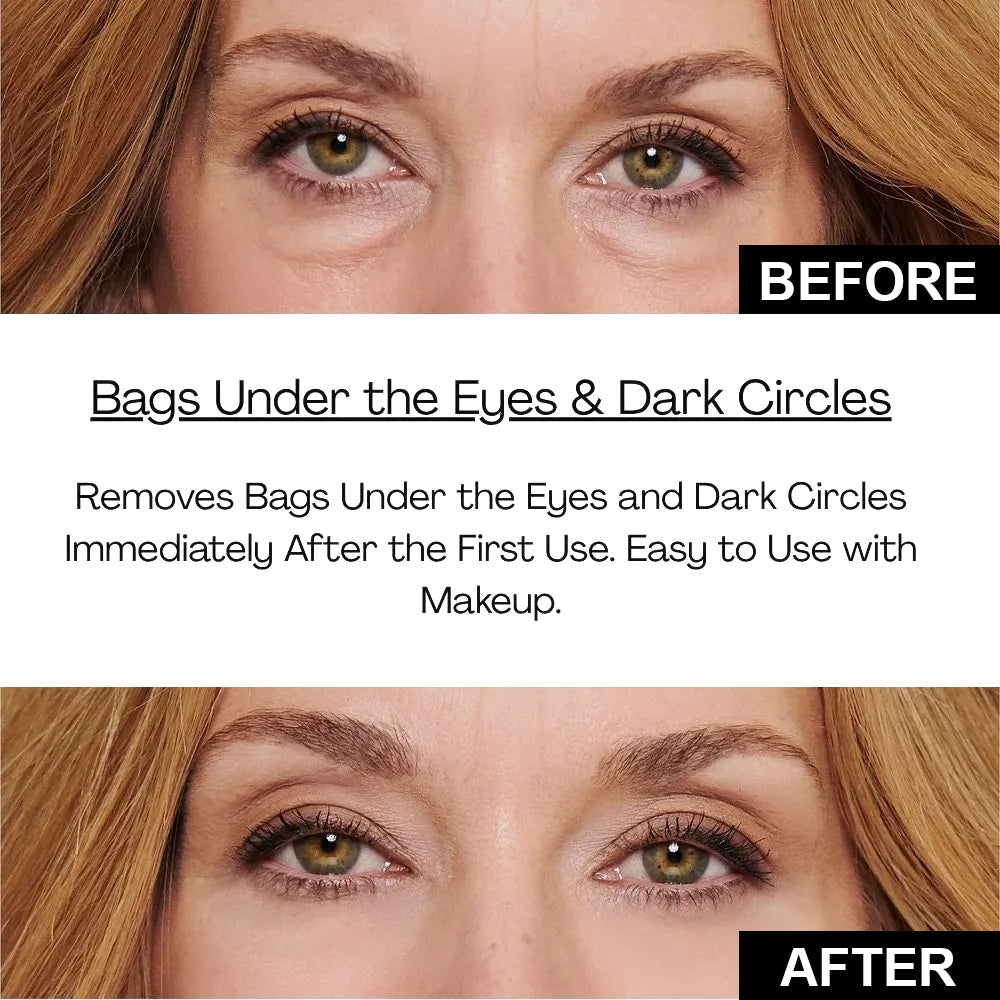 Final 3 Hours: 70%OFF🔥 ODALIT Instant Firm Eye Tightening Cream- Eliminates eye bags & wrinkles 👁✨