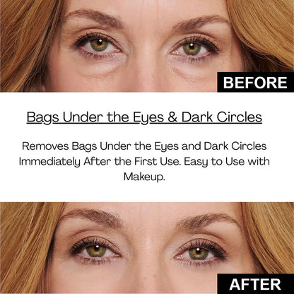 Final 3 Hours: 70%OFF🔥 ODALIT Instant Firm Eye Tightening Cream- Eliminates eye bags & wrinkles 👁✨