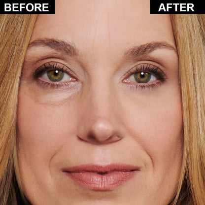 Final 3 Hours: 70%OFF🔥 ODALIT Instant Firm Eye Tightening Cream- Eliminates eye bags & wrinkles 👁✨