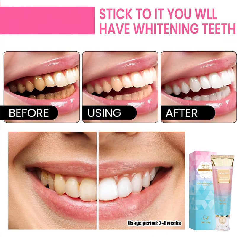 ODALIT™ Niacinamide Whitening Toothpaste-max