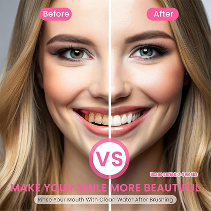 ODALIT™ Niacinamide Whitening Toothpaste-max