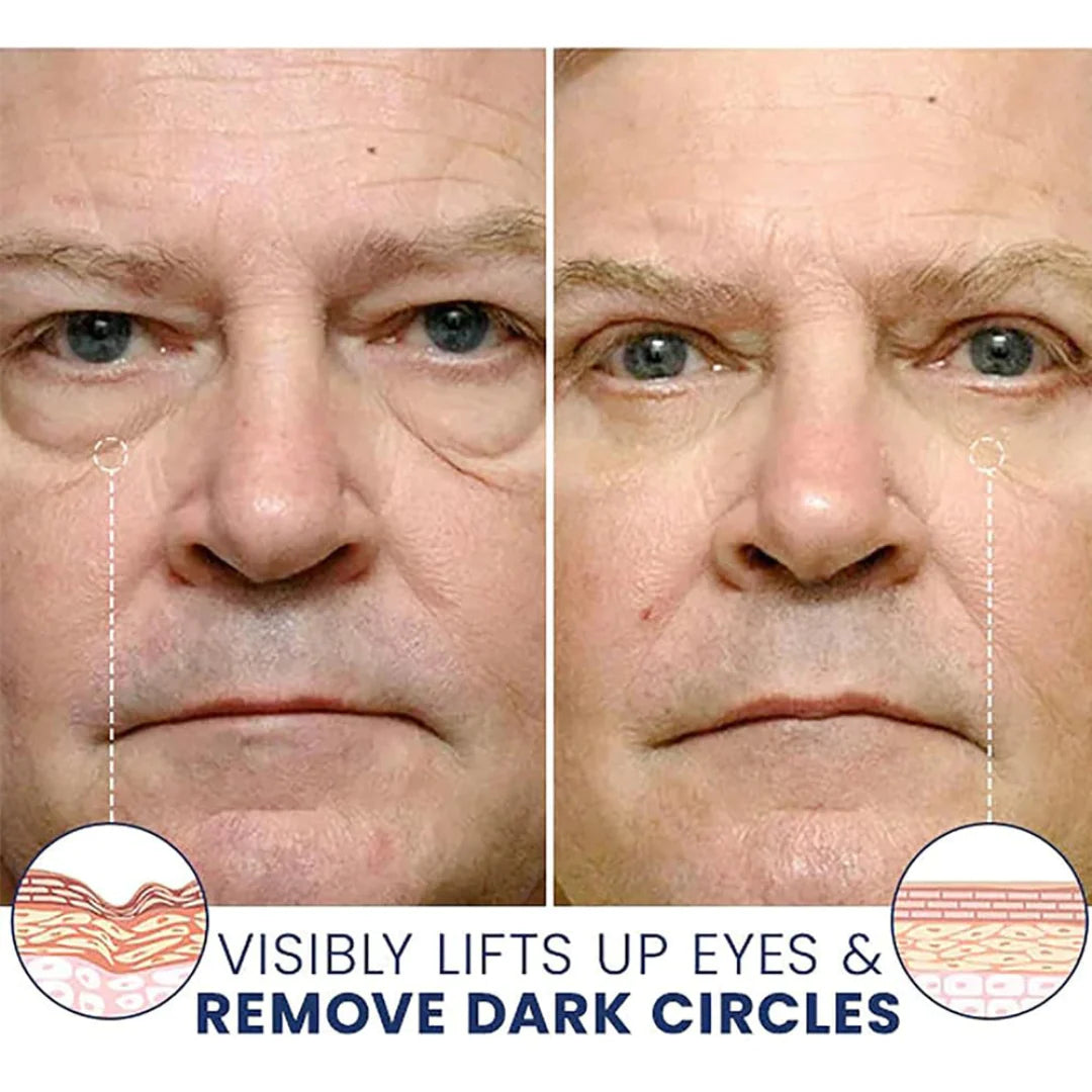 Final 3 Hours: 70%OFF🔥 ODALIT Instant Firm Eye Tightening Cream- Eliminates eye bags & wrinkles 👁✨