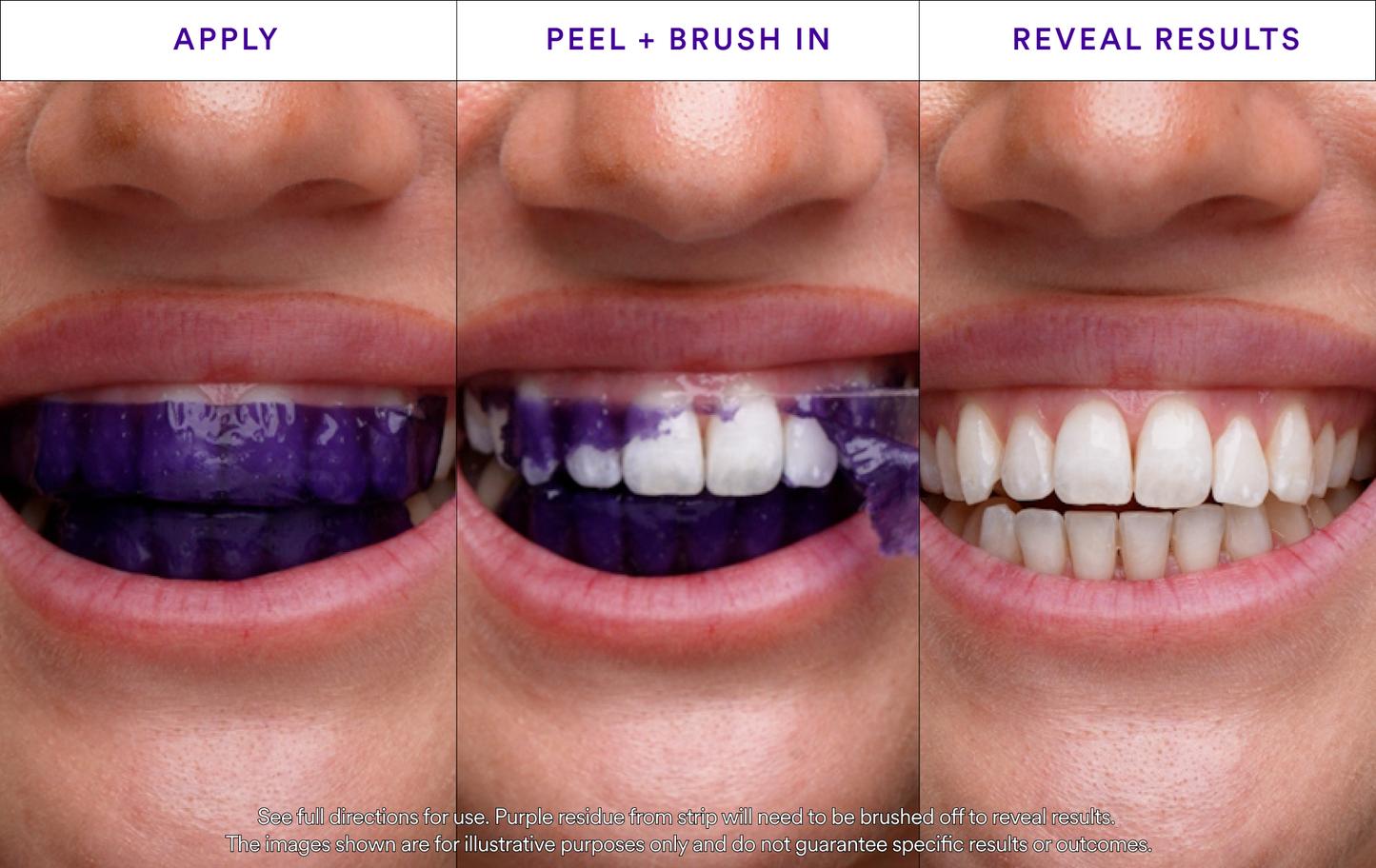 ODALIT™ V34 Whitening Strips