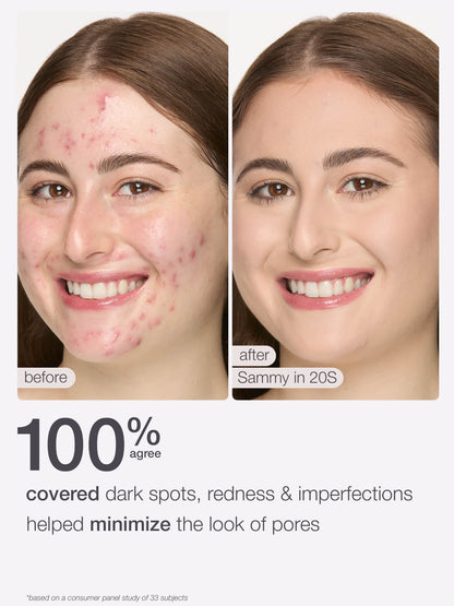 ODALIT™ foundation
