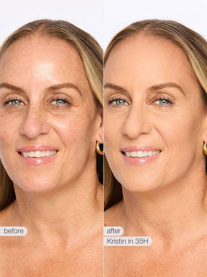 ODALIT™ foundation