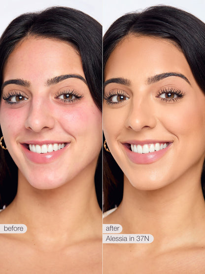 ODALIT™ foundation